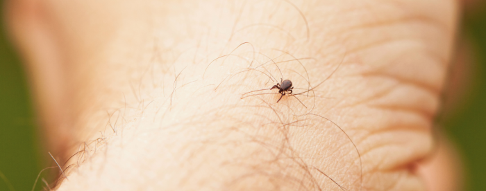 Lähikuva mustasta punkista kävelemässä henkilön iholla.