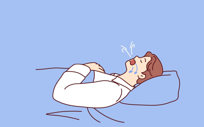 Uniapnea voi vaikeuttaa hengittämistä yöllä ja heikentää unen laatua merkittävästi