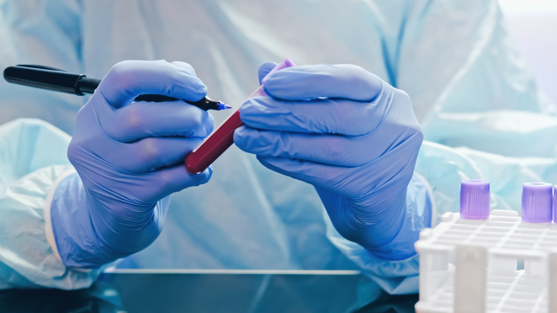 Raudanpuute ja anemia, raudanpuute testi ja diagnostiikka, raudanpuutteen hoito