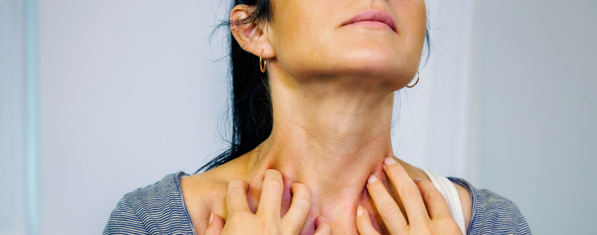 Nainen raapimassa kaulan ympärysihoa